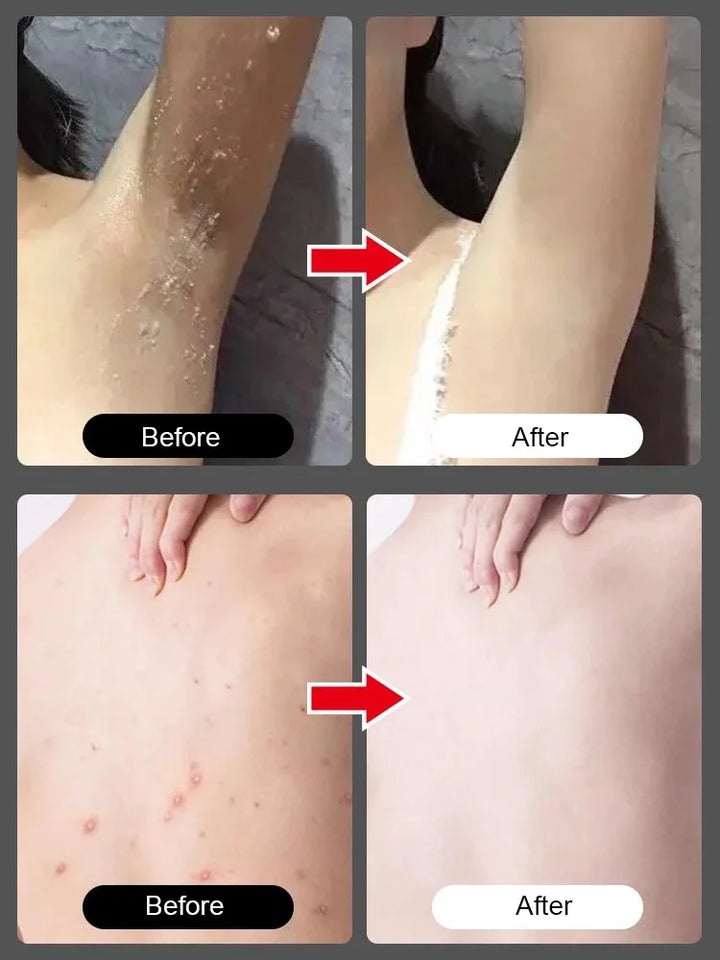 BODY EXFOLIATING NICOTINAMIDE GEL