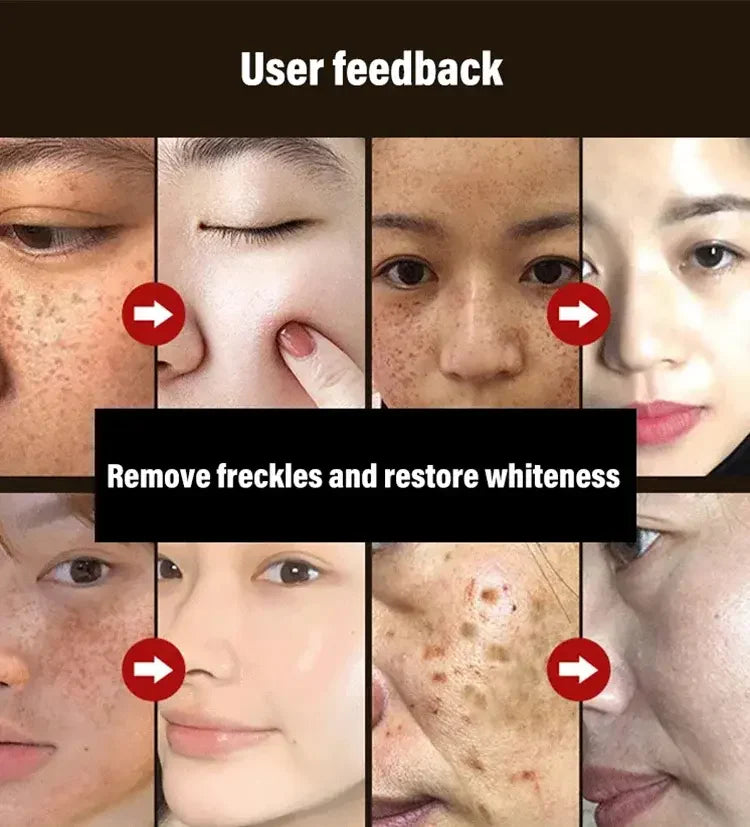 SPOT ABSORBING MASK